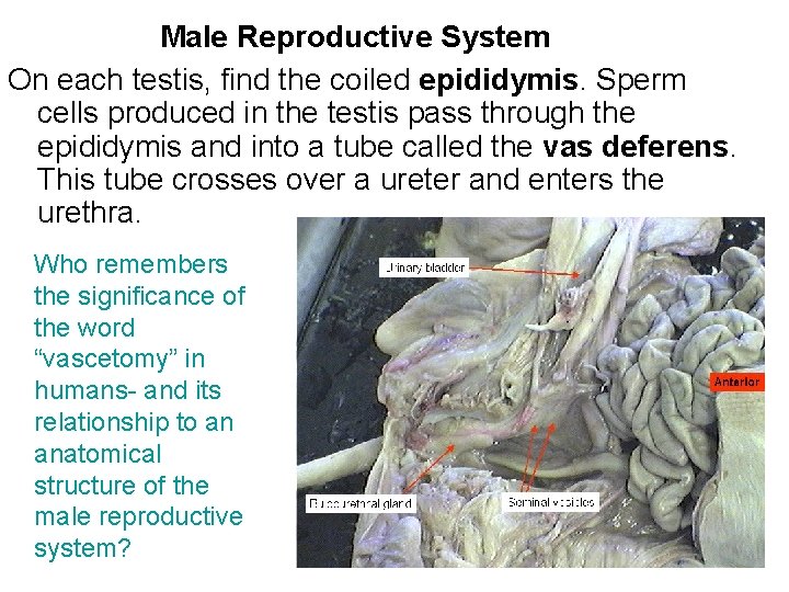 Male Reproductive System On each testis, find the coiled epididymis. Sperm cells produced in