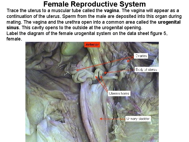 Female Reproductive System Trace the uterus to a muscular tube called the vagina. The