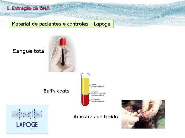1. Extração de DNA Material de pacientes e controles - Lapoge Sangue total Buffy