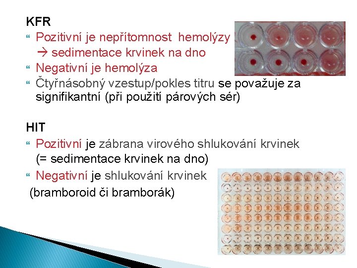 KFR Pozitivní je nepřítomnost hemolýzy sedimentace krvinek na dno Negativní je hemolýza Čtyřnásobný vzestup/pokles