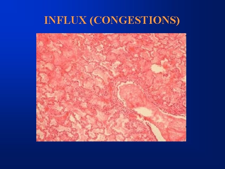 INFLUX (CONGESTIONS) 