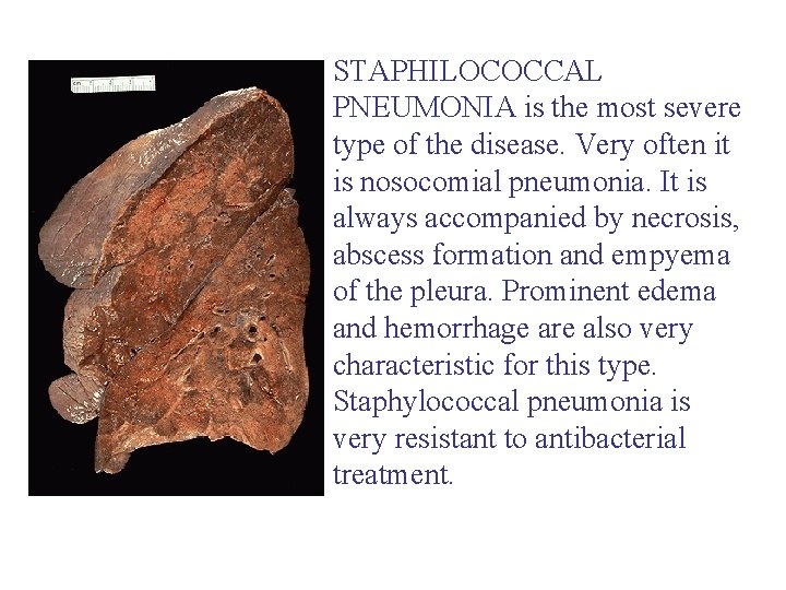 STAPHILOCOCCAL PNEUMONIA is the most severe type of the disease. Very often it is