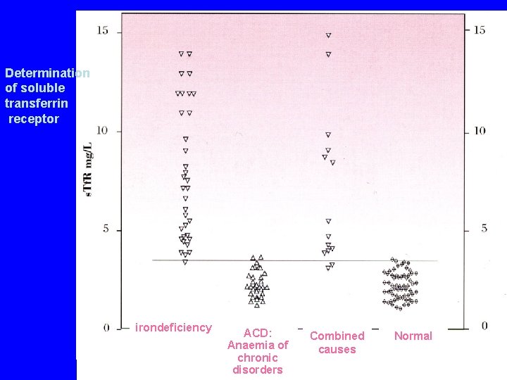 Determination of soluble transferrin receptor irondeficiency ACD: Anaemia of chronic disorders Combined causes Normal