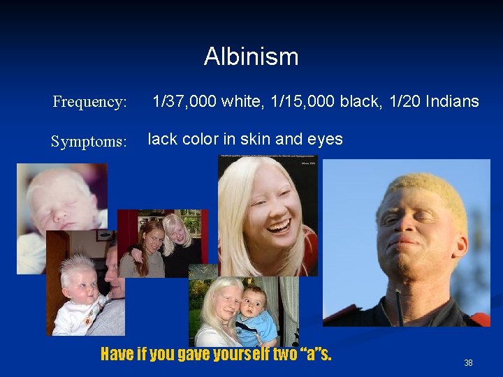 Albinism Frequency: 1/37, 000 white, 1/15, 000 black, 1/20 Indians Symptoms: lack color in