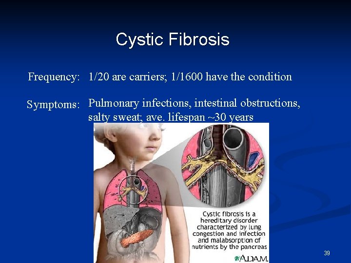 Cystic Fibrosis Frequency: 1/20 are carriers; 1/1600 have the condition Symptoms: Pulmonary infections, intestinal