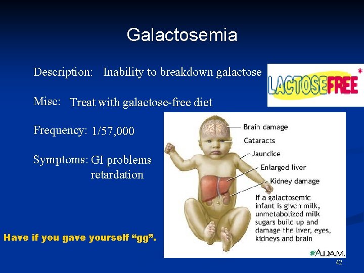 Galactosemia Description: Inability to breakdown galactose Misc: Treat with galactose-free diet Frequency: 1/57, 000