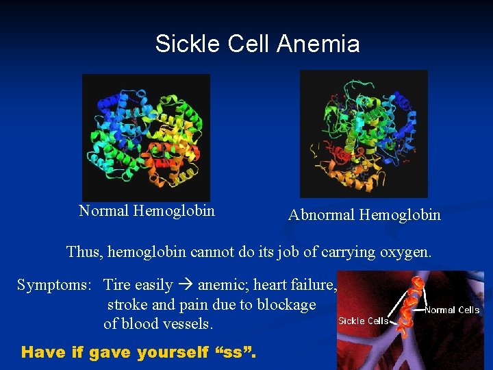 Sickle Cell Anemia Normal Hemoglobin Abnormal Hemoglobin Thus, hemoglobin cannot do its job of