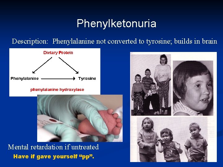 Phenylketonuria Description: Phenylalanine not converted to tyrosine; builds in brain Mental retardation if untreated