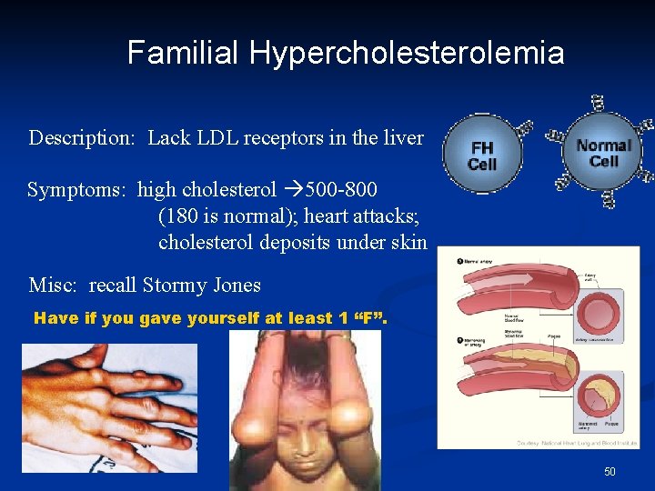 Familial Hypercholesterolemia Description: Lack LDL receptors in the liver Symptoms: high cholesterol 500 -800