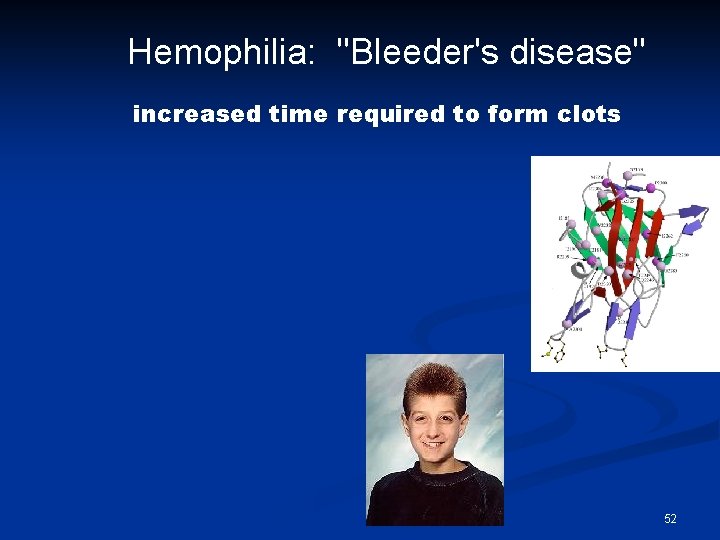 Hemophilia: "Bleeder's disease" increased time required to form clots 52 
