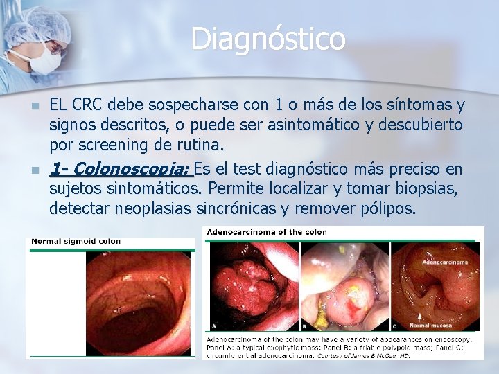 Diagnóstico n n EL CRC debe sospecharse con 1 o más de los síntomas