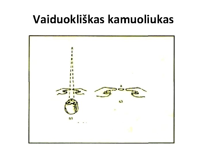 Vaiduokliškas kamuoliukas 
