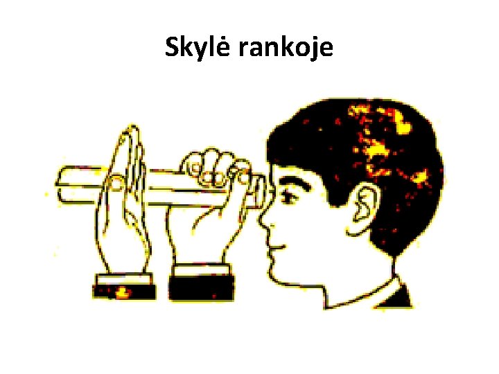 Skylė rankoje 