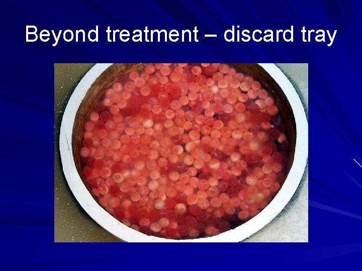 Beyond treatment – discard tray 