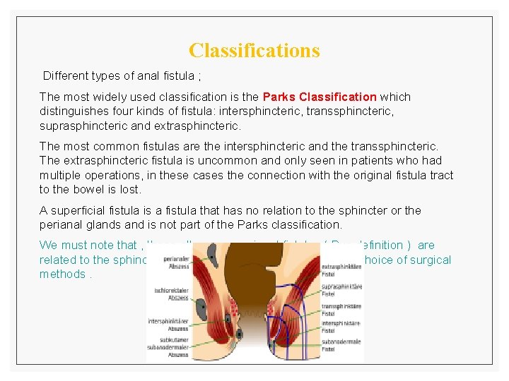 Classifications Different types of anal fistula ; The most widely used classification is the