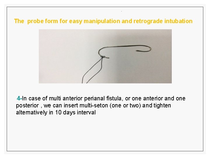. The probe form for easy manipulation and retrograde intubation 4 -In case of