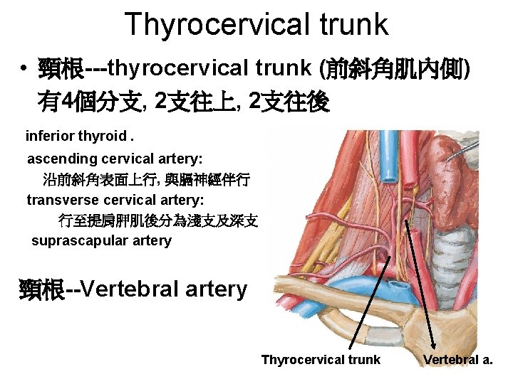 Thyrocervical trunk • 頸根---thyrocervical trunk (前斜角肌內側) 有4個分支, 2支往上, 2支往後 inferior thyroid. ascending cervical artery: