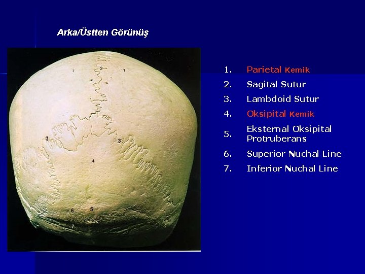 Arka/Üstten Görünüş 1. Parietal Kemik 2. Sagital Sutur 3. Lambdoid Sutur 4. Oksipital Kemik