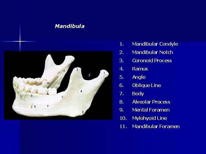 Mandibula 1. Mandibular Condyle 2. Mandibular Notch 3. Coronoid Process 4. Ramus 5. Angle
