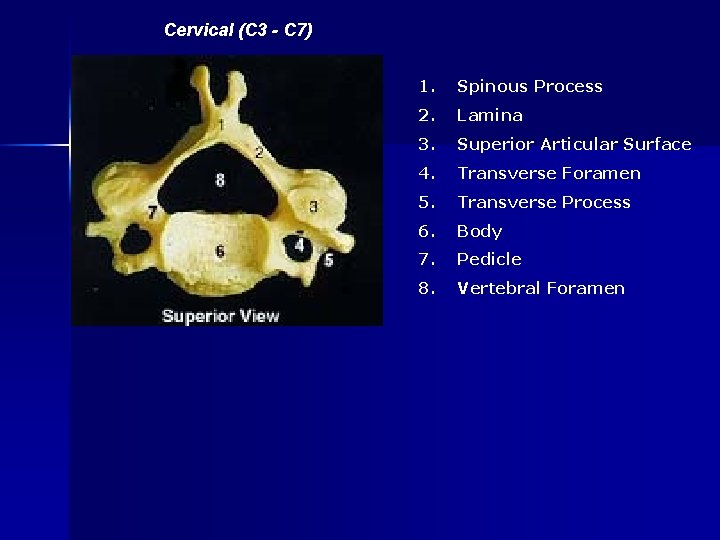 Cervical (C 3 - C 7) 1. Spinous Process 2. Lamina 3. Superior Articular