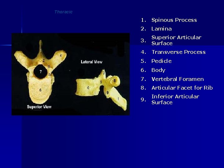 Thoracic 1. Spinous Process 2. Lamina 3. Superior Articular Surface 4. Transverse Process 5.