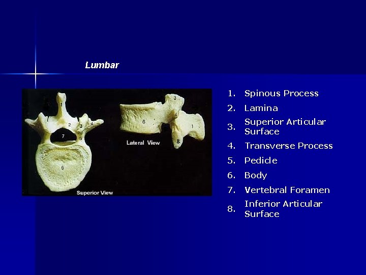Lumbar 1. Spinous Process 2. Lamina 3. Superior Articular Surface 4. Transverse Process 5.