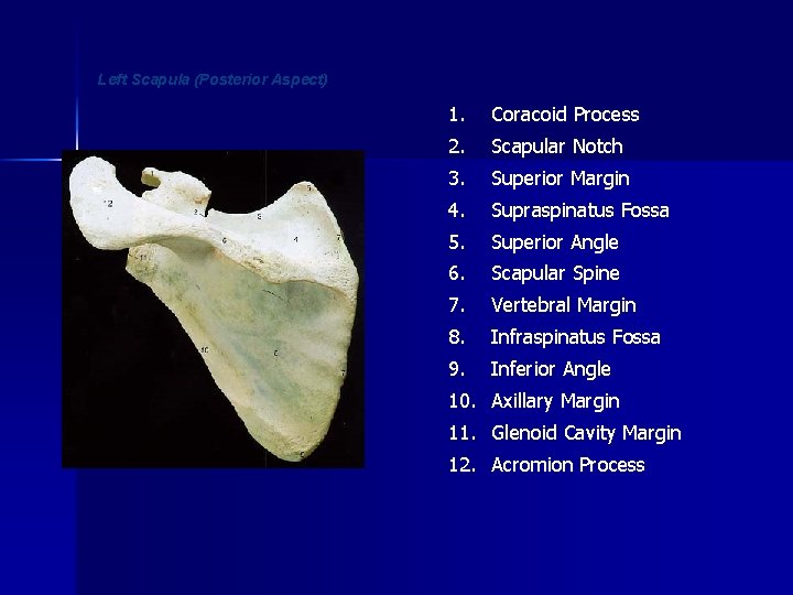 Left Scapula (Posterior Aspect) 1. Coracoid Process 2. Scapular Notch 3. Superior Margin 4.