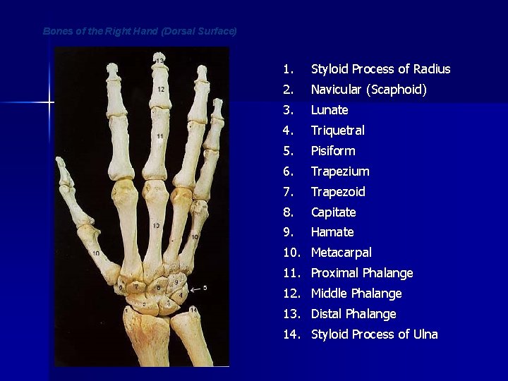 Bones of the Right Hand (Dorsal Surface) 1. Styloid Process of Radius 2. Navicular