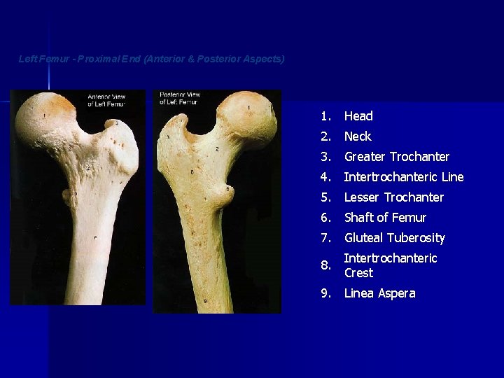 Left Femur - Proximal End (Anterior & Posterior Aspects) 1. Head 2. Neck 3.