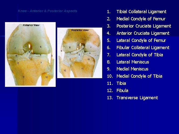 Knee - Anterior & Posterior Aspects 1. Tibial Collateral Ligament 2. Medial Condyle of