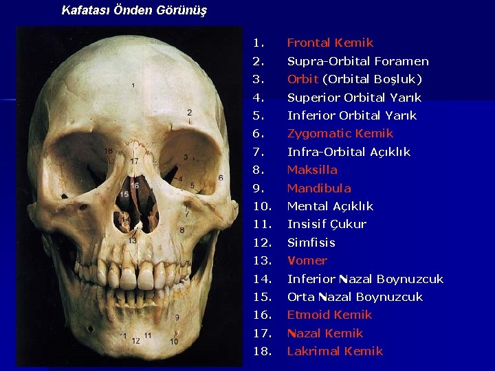 Kafatası Önden Görünüş 1. Frontal Kemik 2. Supra-Orbital Foramen 3. Orbit (Orbital Boşluk) 4.