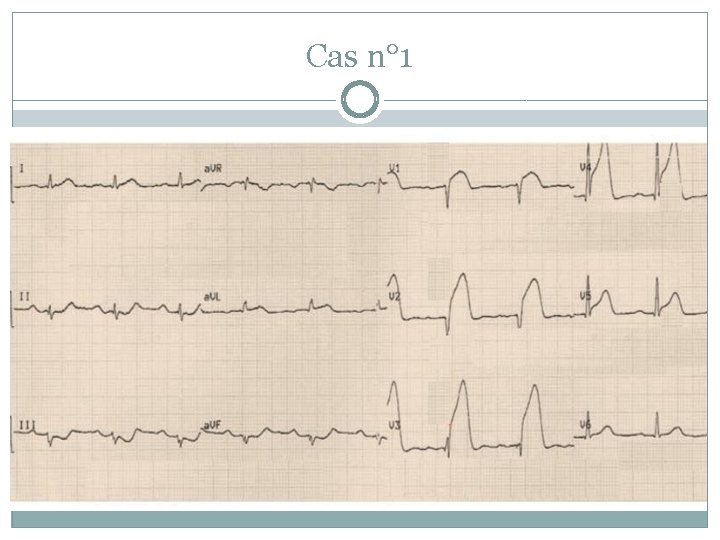 Cas n° 1 