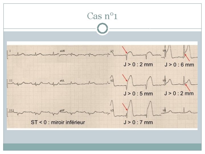 Cas n° 1 