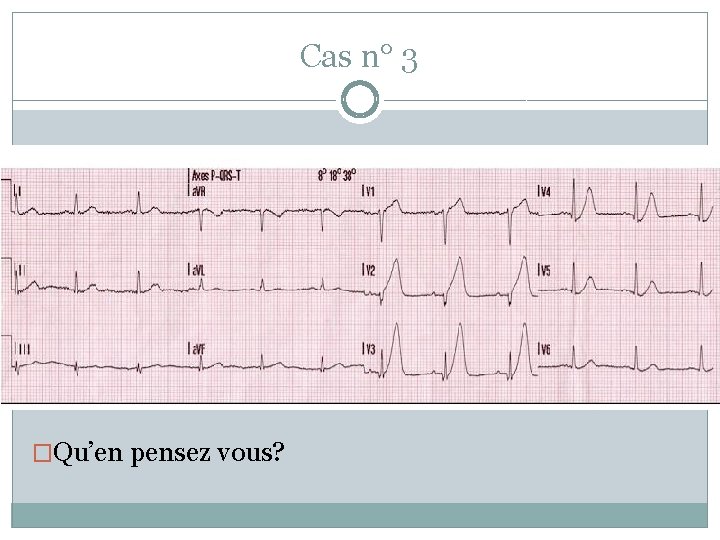 Cas n° 3 �Qu’en pensez vous? 