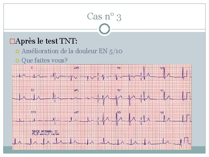 Cas n° 3 �Après le test TNT: Amélioration de la douleur EN 5/10 Que