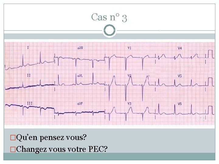 Cas n° 3 �Qu’en pensez vous? �Changez vous votre PEC? 