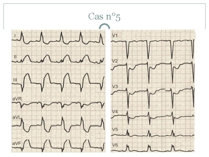 Cas n° 5 