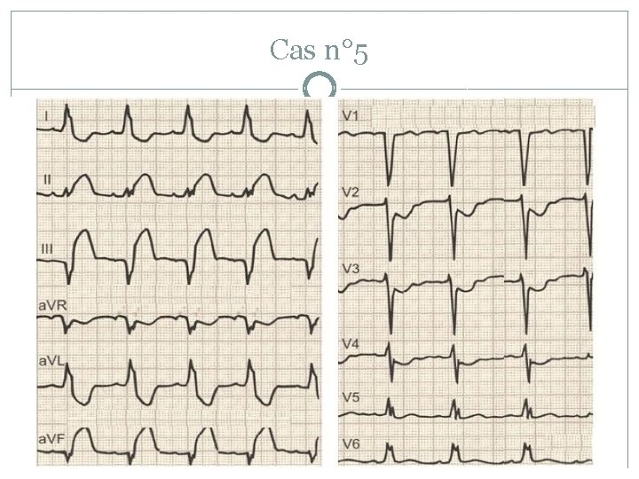 Cas n° 5 