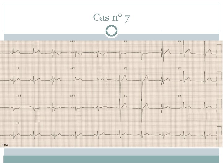 Cas n° 7 