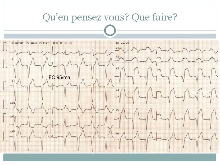 Qu’en pensez vous? Que faire? 