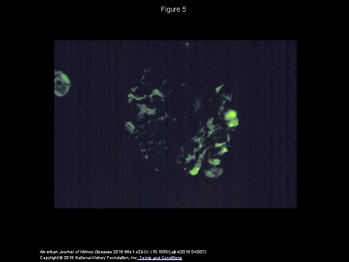 Figure 5 American Journal of Kidney Diseases 2015 66 e 1 -e 2 DOI: