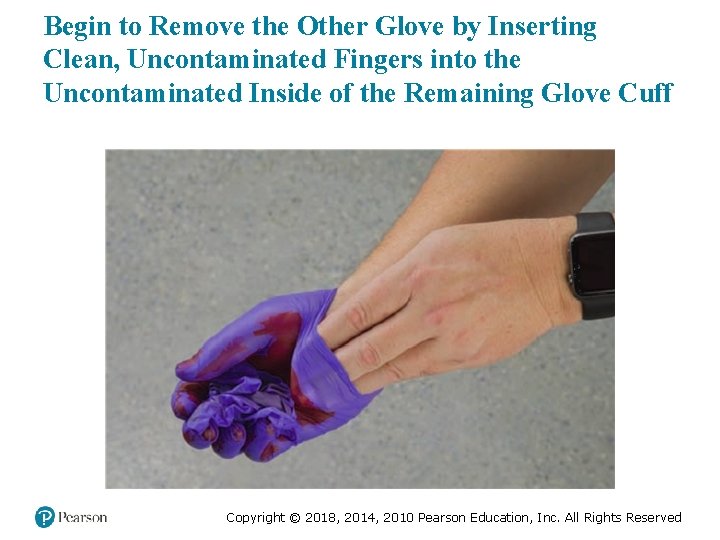 Begin to Remove the Other Glove by Inserting Clean, Uncontaminated Fingers into the Uncontaminated