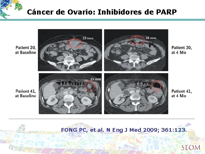 Cáncer de Ovario: Inhibidores de PARP FONG PC, et al. N Eng J Med