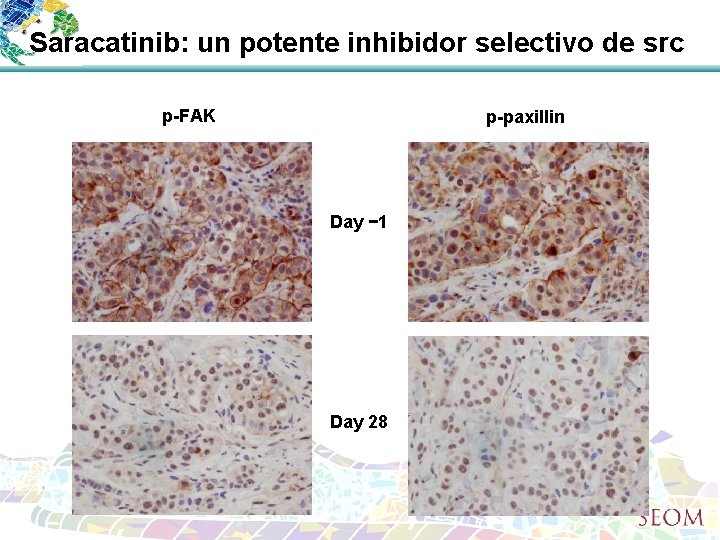 Saracatinib: un potente inhibidor selectivo de src p-FAK p-paxillin Day − 1 Day 28