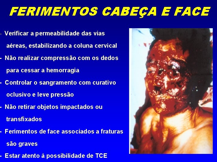 FERIMENTOS CABEÇA E FACE - Verificar a permeabilidade das vias aéreas, estabilizando a coluna