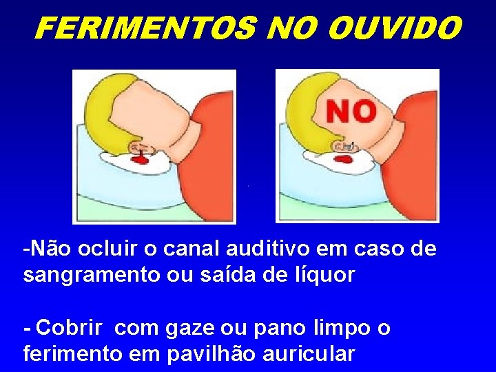 FERIMENTOS NO OUVIDO -Não ocluir o canal auditivo em caso de sangramento ou saída