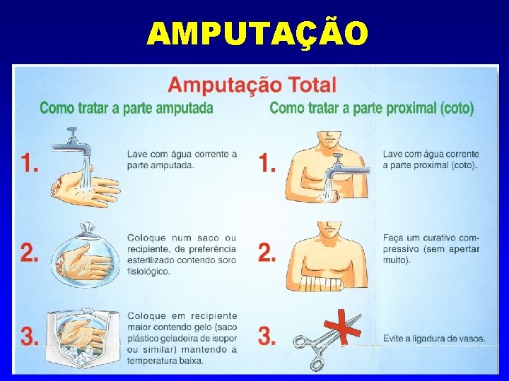 AMPUTAÇÃO 