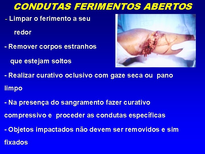 CONDUTAS FERIMENTOS ABERTOS - Limpar o ferimento a seu redor - Remover corpos estranhos
