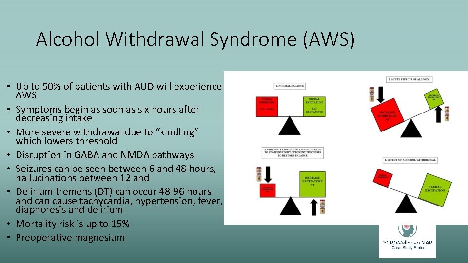 Alcohol Withdrawal Syndrome (AWS) • Up to 50% of patients with AUD will experience