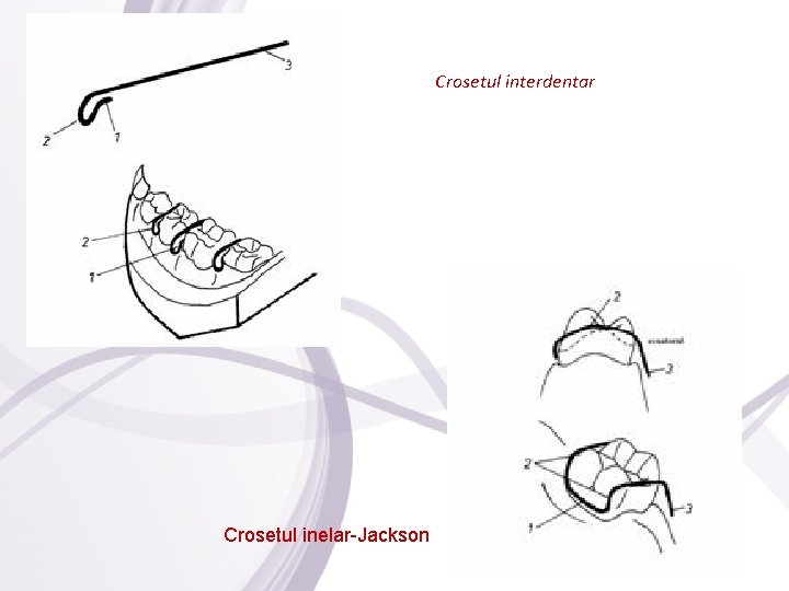 Crosetul interdentar Crosetul inelar-Jackson 